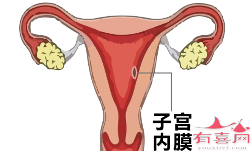 子宫内膜脱落是正常的