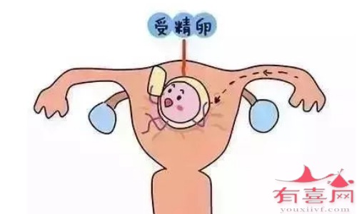 子宫内膜炎主要有什么危害