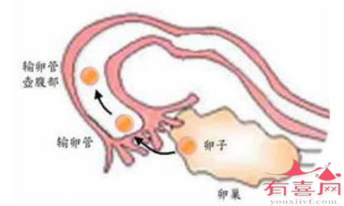 慢性输卵管炎对怀孕有影响