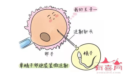 抗卵巢抗体阳性可以通过试管婴儿生育