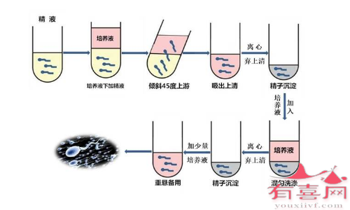 精子洗涤技术