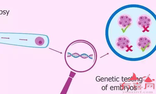 PGS、PGD基因检测