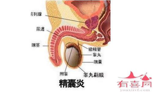 精囊炎吃什么药效果好见效快