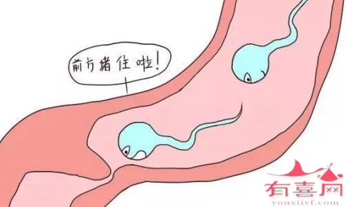 男子输精管堵塞能疏通吗