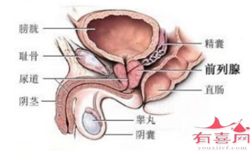 前列腺肥大增生能做试管婴儿吗