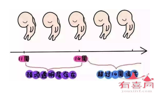 在孕11～13周+6天之间进行