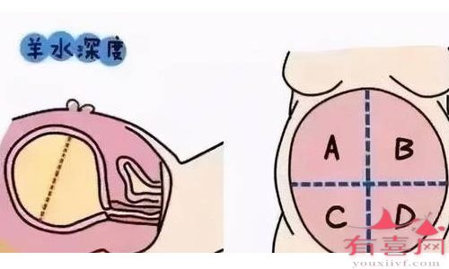 羊水深度不能看胎儿性别