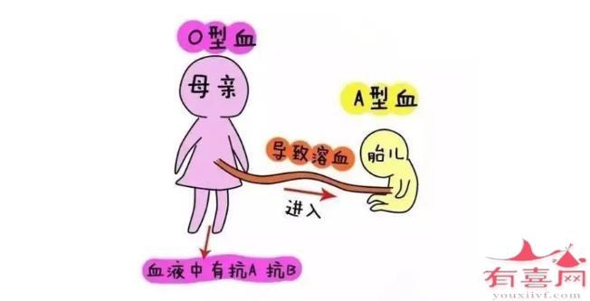 什么是新生儿溶血症